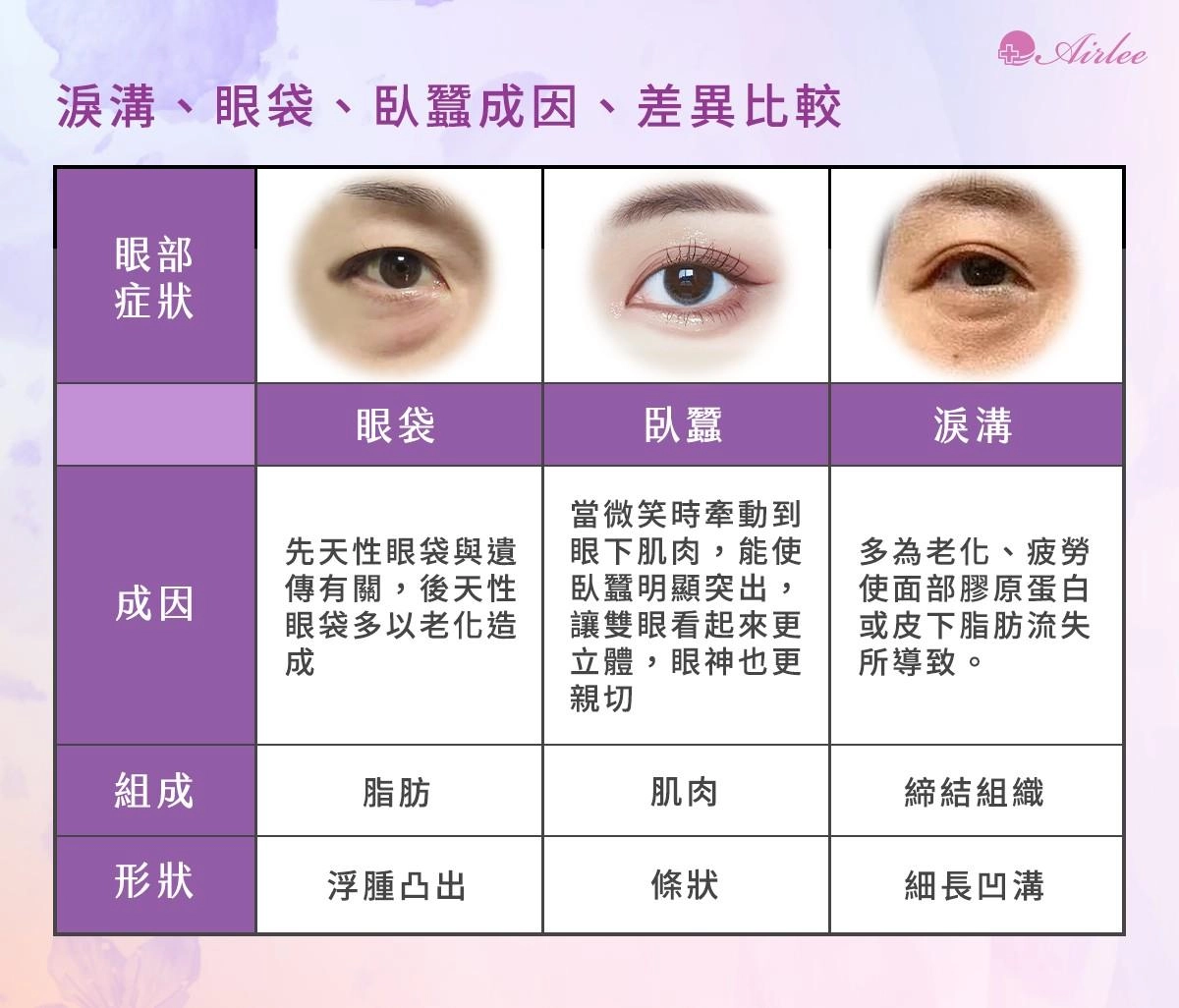 眼袋、眼袋腫、眼袋怎麼辦、眼袋手術、無刀眼袋、愛爾麗醫美